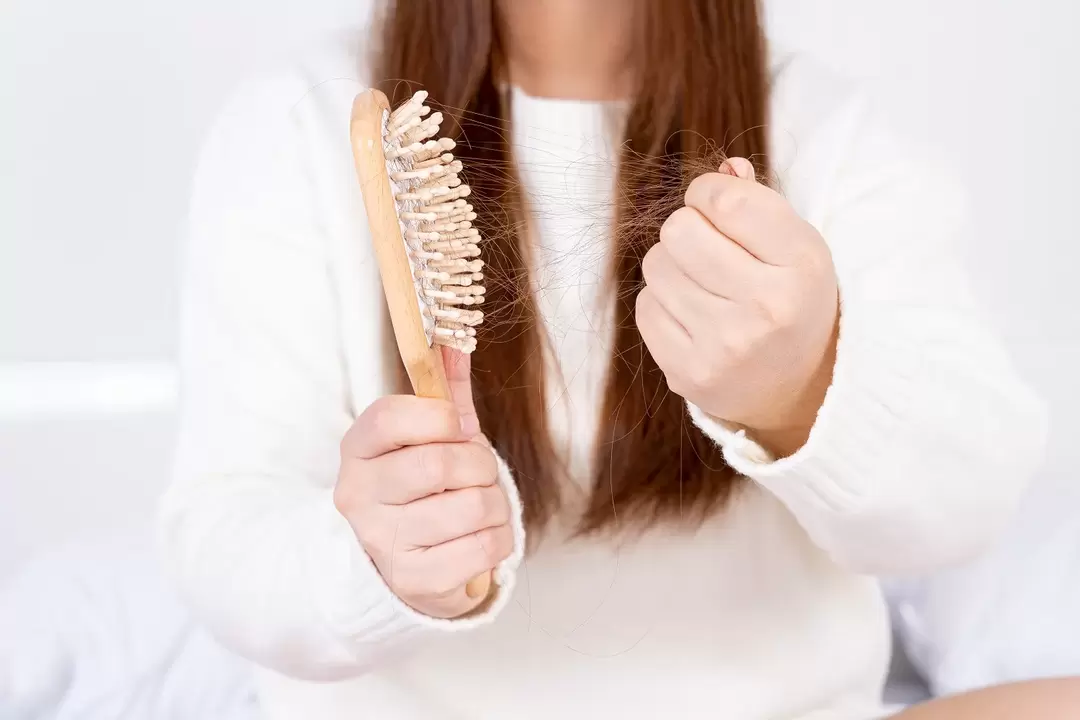 hair loss and treatment with a spray Verdexedil